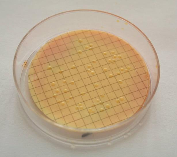 Figure A1 Colonies of presumptive E. coli at 44 C on membrane lauryl sulphate broth Tests for β-glucuronidase will assist in the confirmation of E.