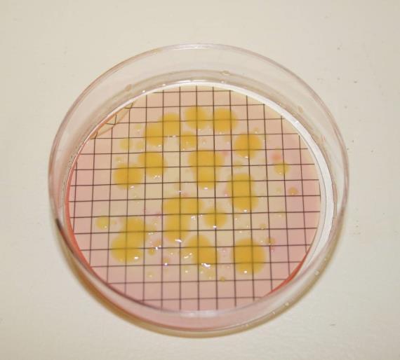Figure A2 Colonies of Klebsiella species isolated from surface water at 44 C on membrane lauryl sulphate broth A9.