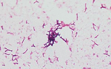 Figure 1 Gram stain of Bifidobacterium spp. A10 Calculations A10.