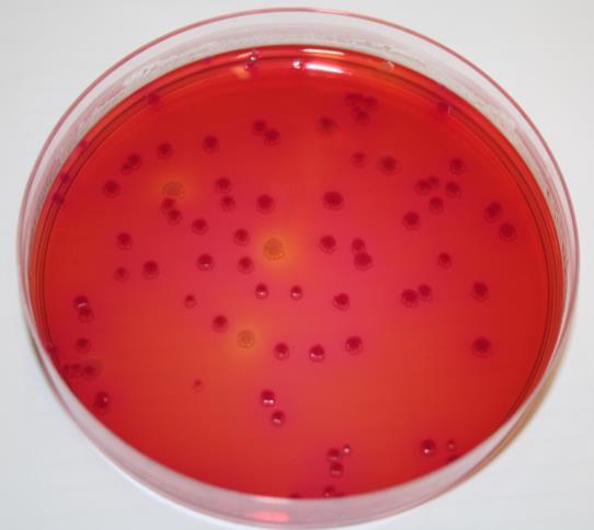 Figure B1 Lactose positive (pink) and lactose negative (orange) colonies of Salmonella Typhimurium WG49