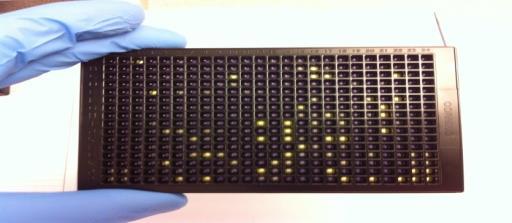Utilizing our MM mutation panels, we will conduct a chemogenomic interrogation to