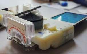 Innovation - opportunities through new diagnostics Handheld lab