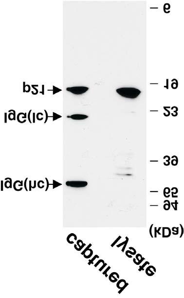 SPECIFICITY This Duoset IC ELISA is specific for human total p21. Specificity was demonstrated by Western blot analysis of protein bound by the capture antibody supplied in the kit.