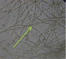 moniliforme was done using slide bi-culture test. Fig. 3, A shows the growth Trichoderma sp. and F.