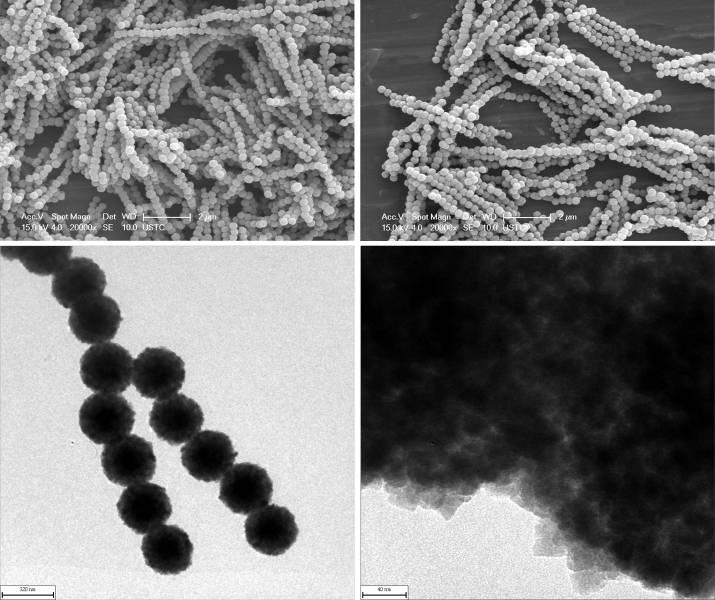 Figure S2. SEM and TEM images of the partially hollow Fe 3 O 4 chains reacted for 5 h.