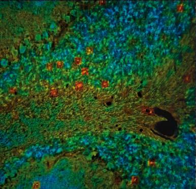 Color coded FLIM image (ps) of mouse kidney section stained for the podocyte specific protein Podocin (Alexa Fluor 488, green), the basement membrane marker Nidogen (Alexa Fluor 555, red) and Nuclei