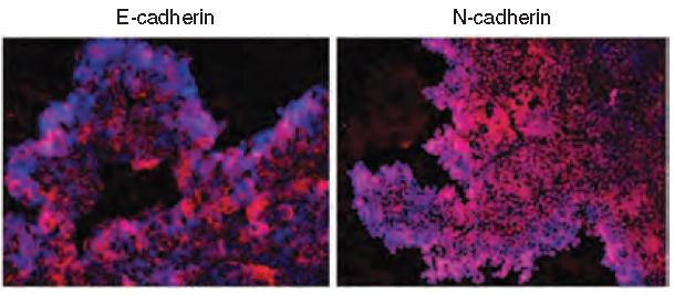 Positive staining patterns for mucin-5ac, cytokeratin-19 and E-cadherin verified epithelial phenotype