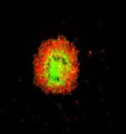 tumor cells, liver cells), (I) Formation of stem cell aggregates, (II) Platform