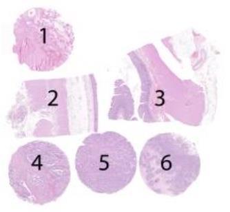 Assessment Run 50 207 Cytokeratin 9 (CK9) Material The slide to be stained for CK9 comprised:. Thyroid gland 2. Esophagus 3. Colon 4. Thyroid papillary carcinoma 5. Breast carcinoma 6.