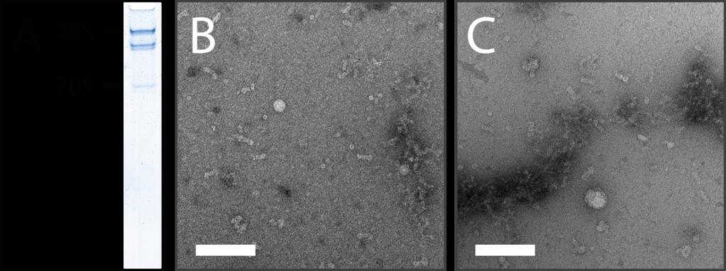 Supplementary Figure 3: Electron micrographs of 26S proteasomes blotted from native gels Purified 26S proteasomes from Drosophila melanogaster were subjected to native gel electrophoresis on 3-8 % TA