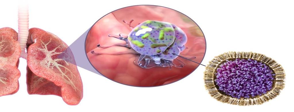 Macrophage NTM ALIS Macrophage Advanced liposome technology delivers drug directly to