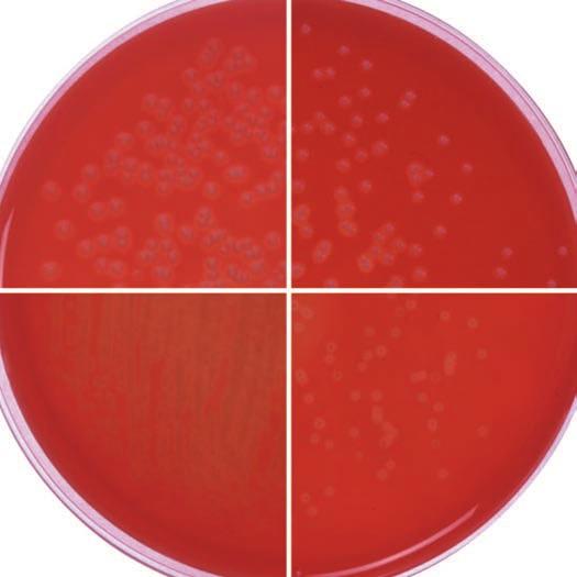 ryptose Blood Aar Base, cont. Difco ryptose Blood Aar Base Dehydrated Appearance: Beie, free-flowin, homoeneous. 3.3% solution, soluble in purified water upon boilin.