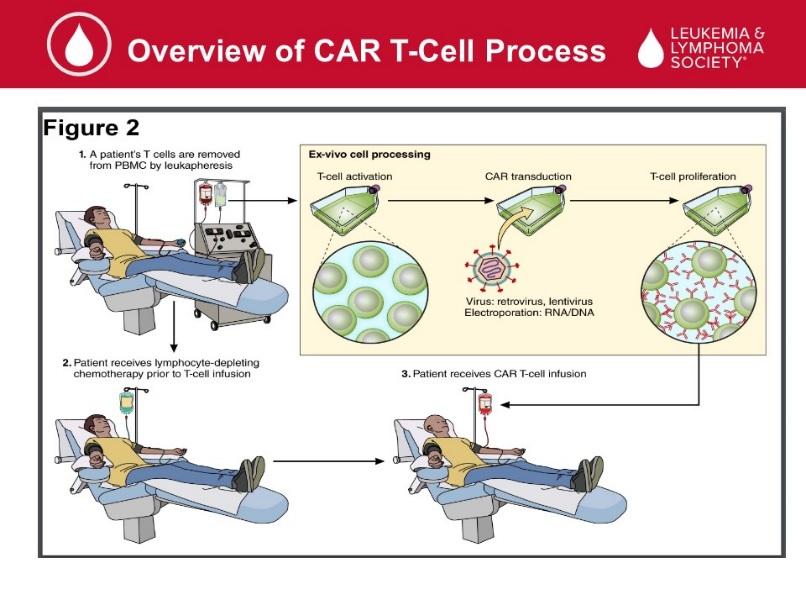 What does that look like for the patient? We have to first collect the T-cells.