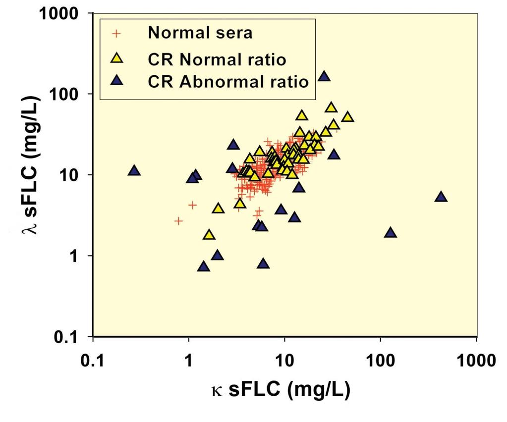 Abnormal FLC ratios indicate residual disease in Light
