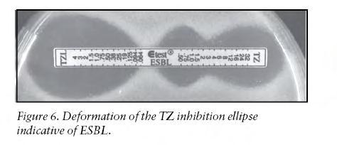 The CT or TZ inhibition ellipse may