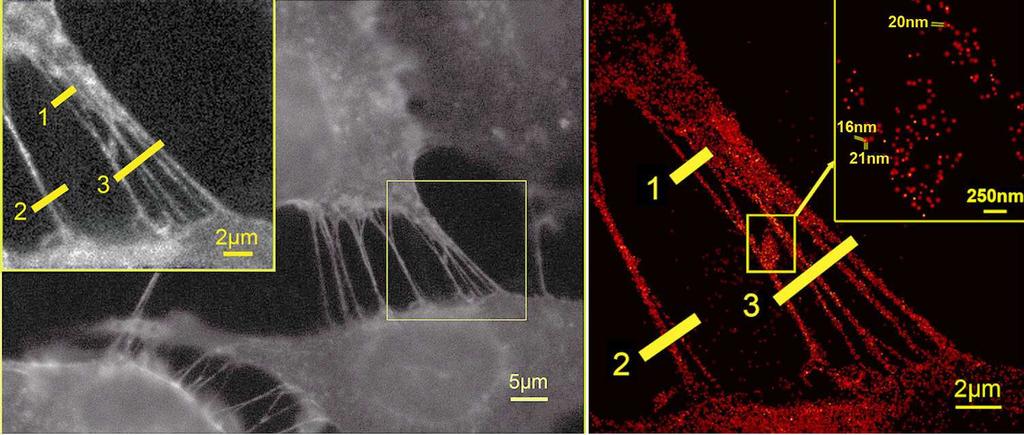 In combination with localization microscopy SPDM (Spectral Precision Distance Microscopy) using physically modifiable fluorochromes (Phymod) it is possible to record nanoscopic images identifying the