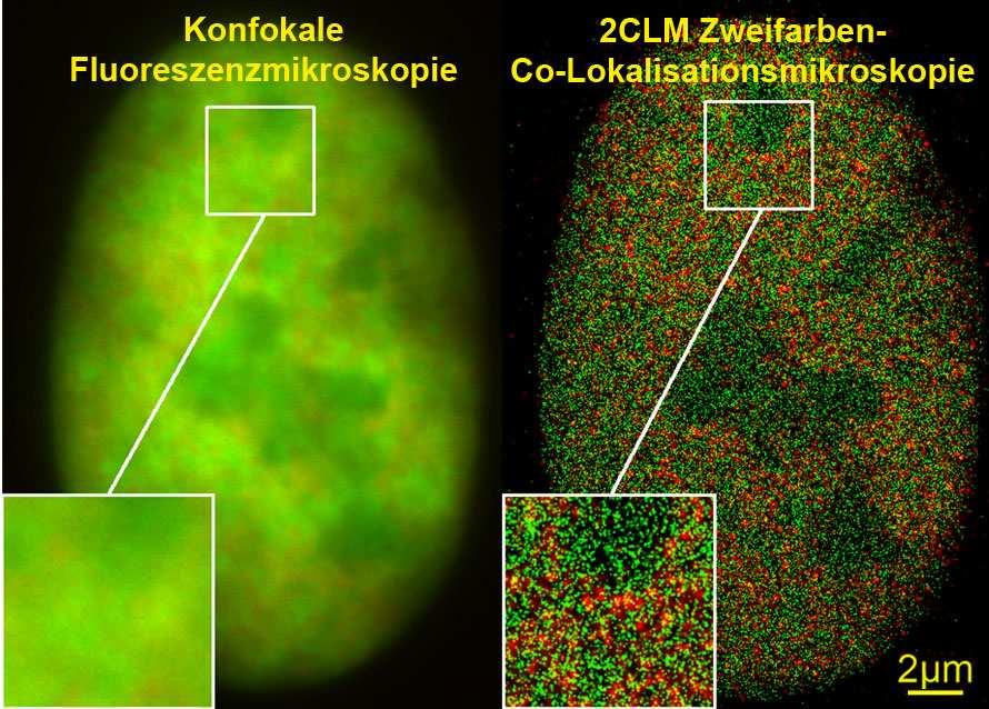 single molecule resolution at a molecular density that is better by a factor of 30 than conventional light microscopy together with a spatial resolution that is 20 times better.