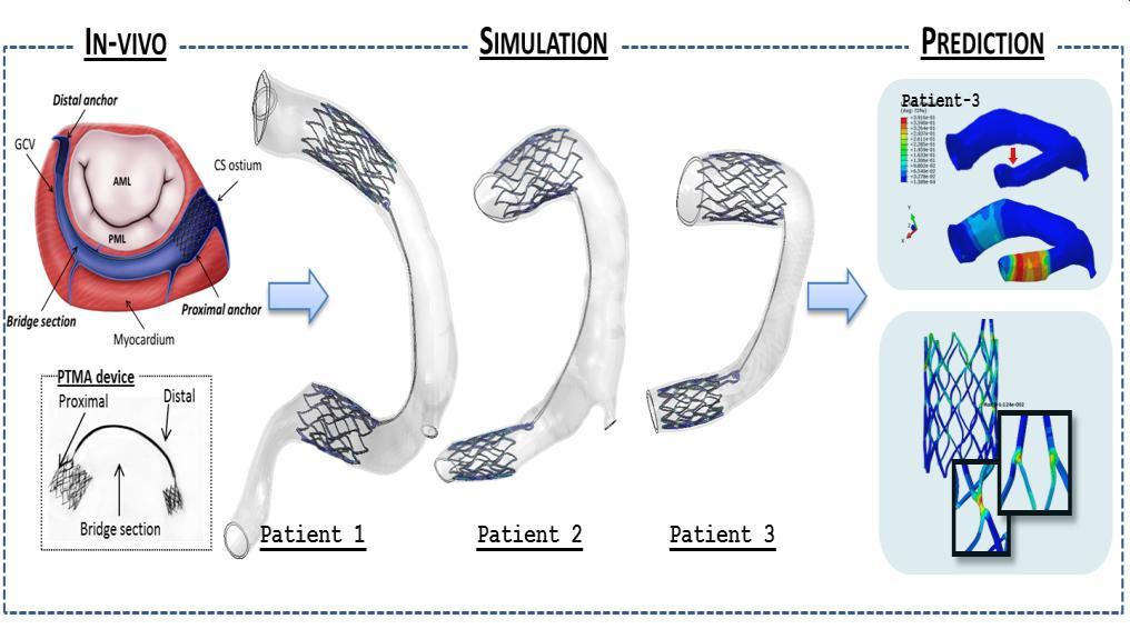 Experimental study and modeling of cardiovascular biomaterials Studies tissue and organ function Designing and surgical reconstruction of new heart valves Works closely with
