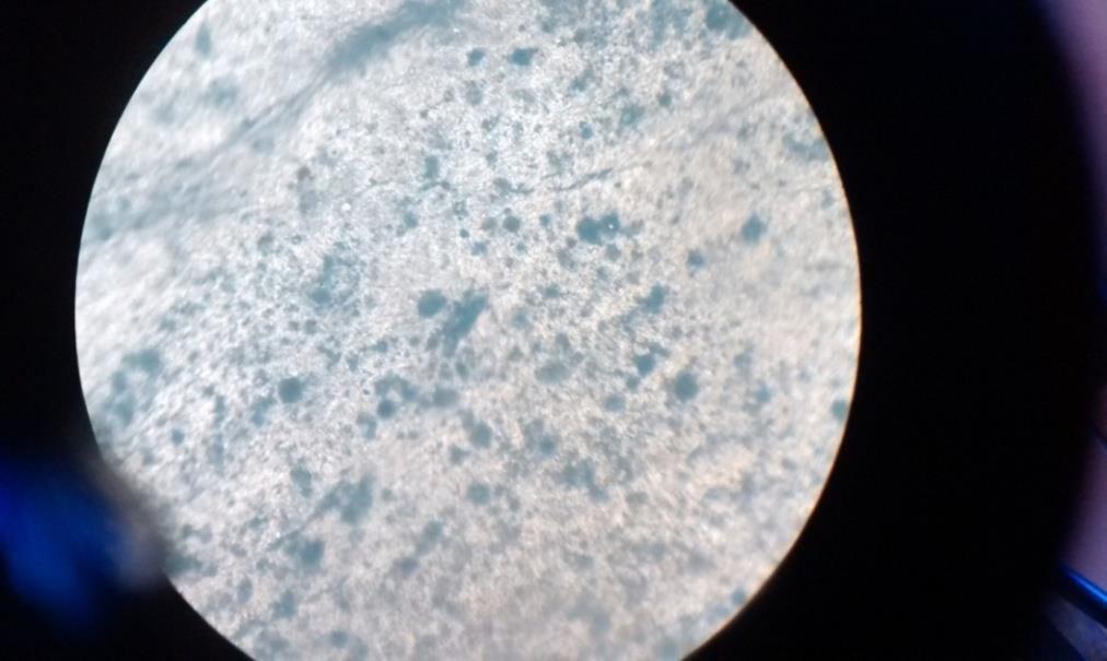 Micrococcus sp. (belong to Gram- positive bacteria); Moraxella sp. and Pseudomonas sp. (belong to Gram-negative bacteria). S. aureus, P.