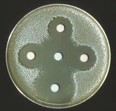 ANTIBIOTIC: A chemical that inhibits the growth of bacteria How do they work?