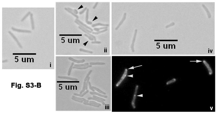 Fig. S3. (A) FtsI and FtsZ levels in M. smegmatis WT and crga strains expressing Pami::gfp-ftsI. M. smegmatis strains were grown as described in the text and processed for immunoblotting.