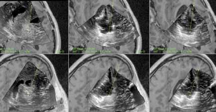Easy to Understand Easy to Use Neurosurgeons today are highly familiar with the use of MR images.