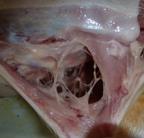 (B) Skin incision of a homozygous FBN1 mutant piglet revealed that subcutaneous adipose tissue of the chest, front neck,