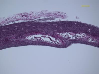 (A) Histology of the wall of the ascending aorta stained