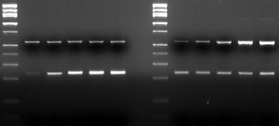 M 1 2 3 4 5 M 6 7 8 9 10 Fig 3. Housekeeping gene and target specific gene are amplified independently in a single tube. M: 100 bp DNA M.W.
