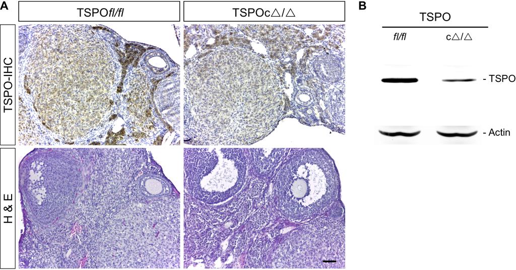 Supplemental Figure 3 Supplemental Figure 3. TSPO deletion in TSPOcΔ/Δ mouse ovary. (A) Immunohistochemical localization showing a decrease in TSPO positive cells in TSPOcΔ/Δ ovaries.