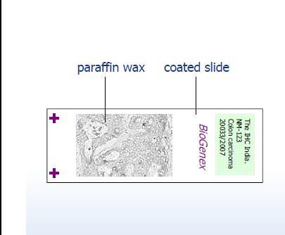 Slide preparation 5-8 micron tissue sections are cut onto slides Charged slides provide adhesion to
