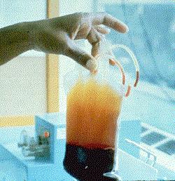 Whole Blood Unit After centrifugation whole blood separates into the plasma and platelets on top