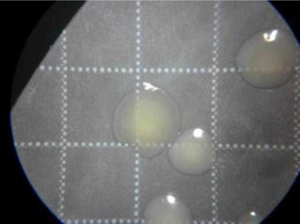 Figure 2 Pall Metricel Black PES Membrane under microscope Day 7 Pall Metricel