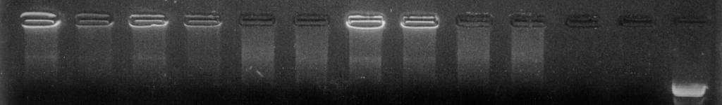 PCR for normal b