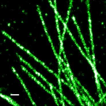 Microtubules: good and bad