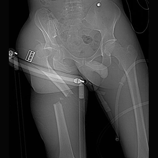 X-ray images