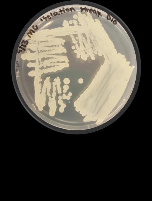 A B 1 cm 1 cm C D 1 cm 1 cm Figure 2. Isolation and morphology of two bacterial colonies with zones of inhibition against Staphylococcus aureus and Escherichia coli.