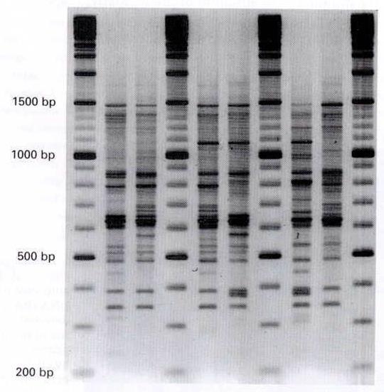 25 Random Amplified Polymorphic DNA