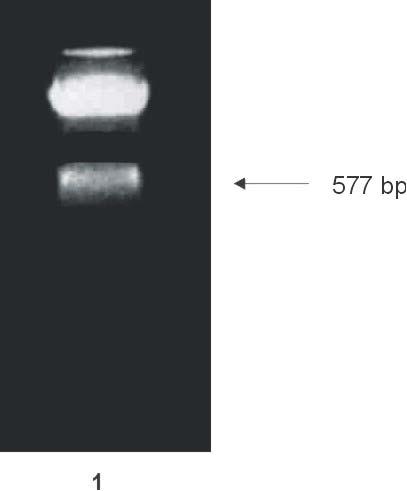 220 pbluescript KS+ PTP-1B clone 1 restriction digestion Bluescript KS+ PTP-1B clone 1 (A-B orientation) was digested with BamHI and Bst ZI to release a modified 577bp PTP-1B insert (figure 57).