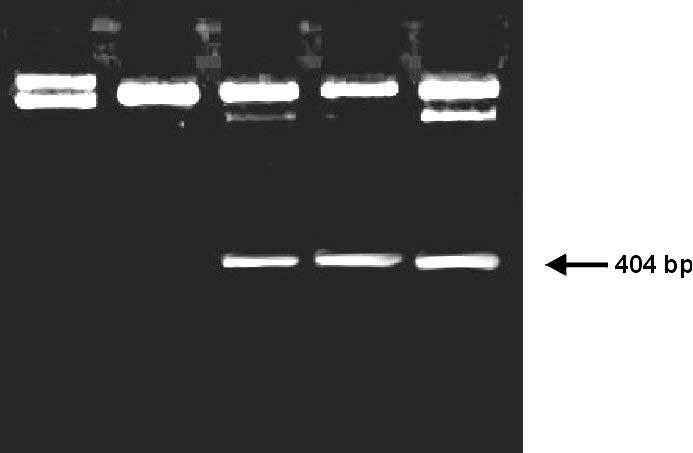 224 PTP-1B pgex-4t-1 clone restriction digestion The three clones described in figure 60 (#1, #2 and #3) were digested with AVA I to release a 404 bp PTP-1B insert (lanes 3, 4 and 5 are positive