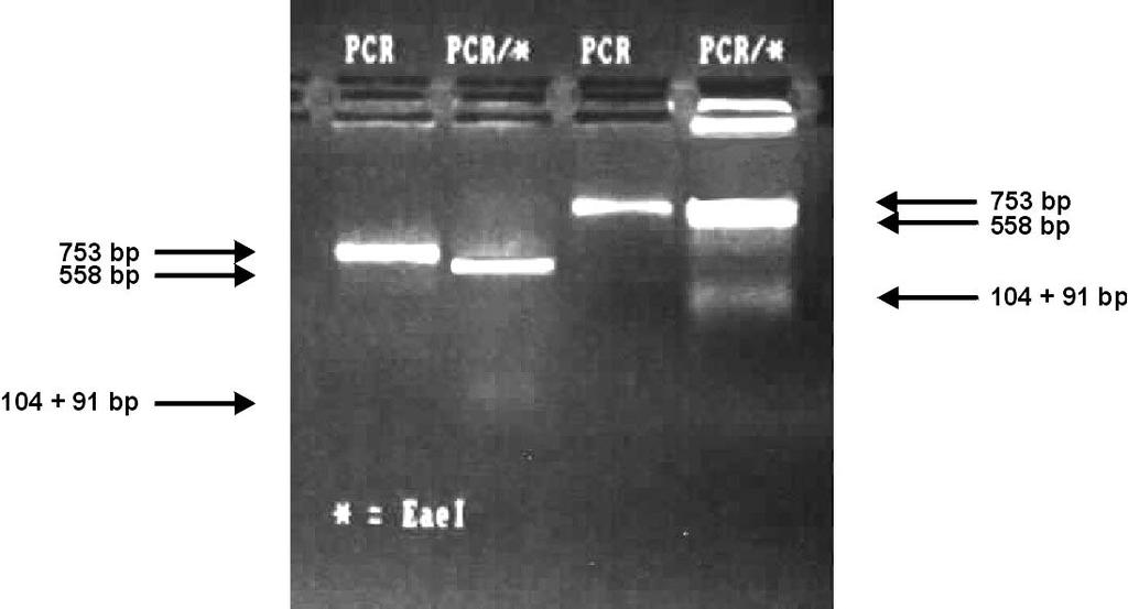 212 Preparation of PCR product for cloning PTP-1B RT-PCR product digested with Eae I restriction endonuclease produced three fragments (558, 104 and 91 bp).