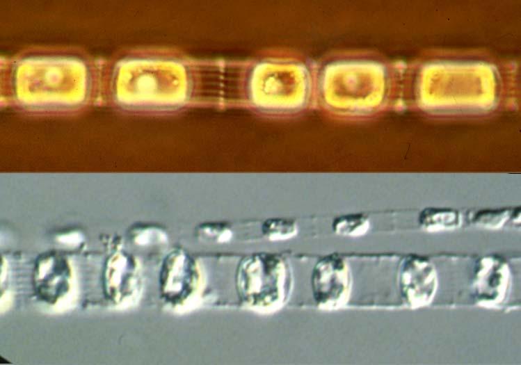 Cells forming a group (case 1) about 10 micrometer S Group?