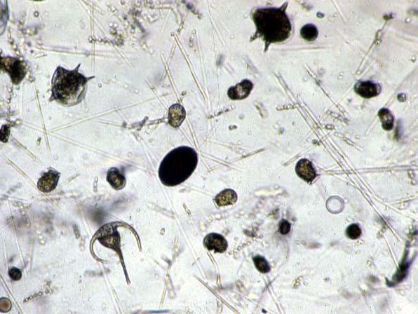 Plankton group (Live specimen) group of cells pollen egg of zooplankton Some of organisms are