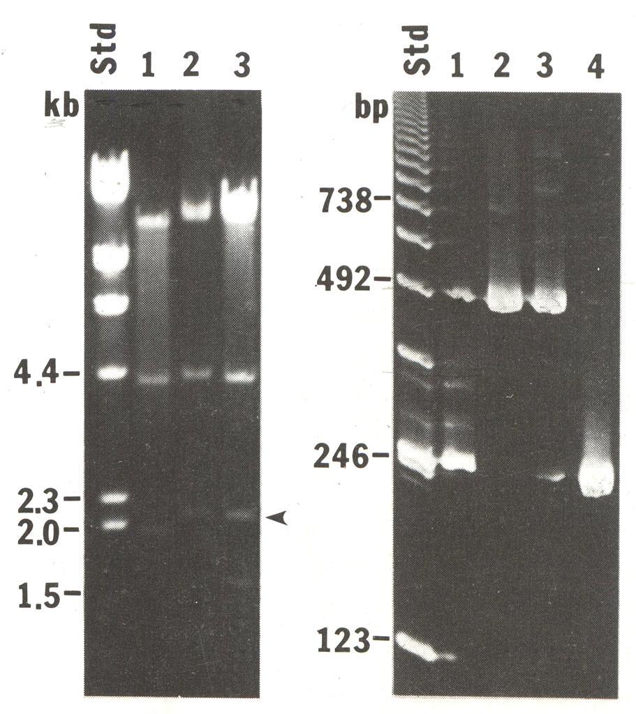 Nucleic Acids Electrophoresis Agarose gel or polyacrylamide gel. Agarose gel used for separation of large nucleic acid.