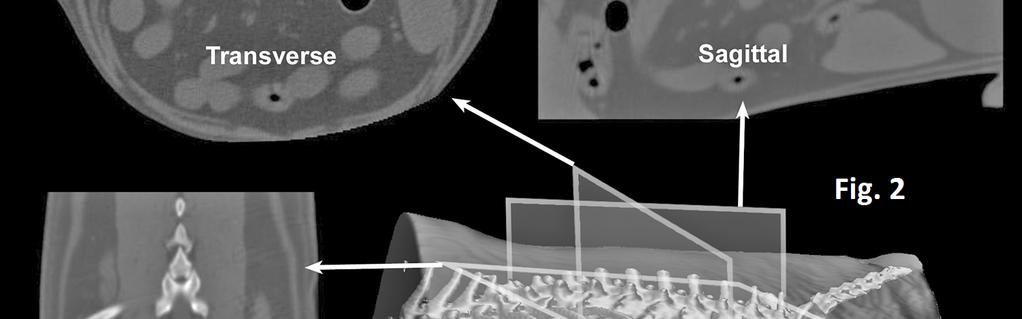 As opposed to radiographs that represent flat projections of tridimensional (3D) structures, tissues are examined with CT and MR in thin slices thereby eliminating superimposition.