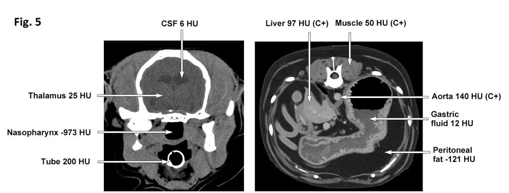 Interpretation of CT images necessitates an understanding of the range of HU found in different types of normal and abnormal tissues.