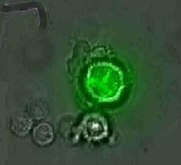 Molecular Cloning Use of Reporter (marker) gene: β-galactosidase gene - Break down