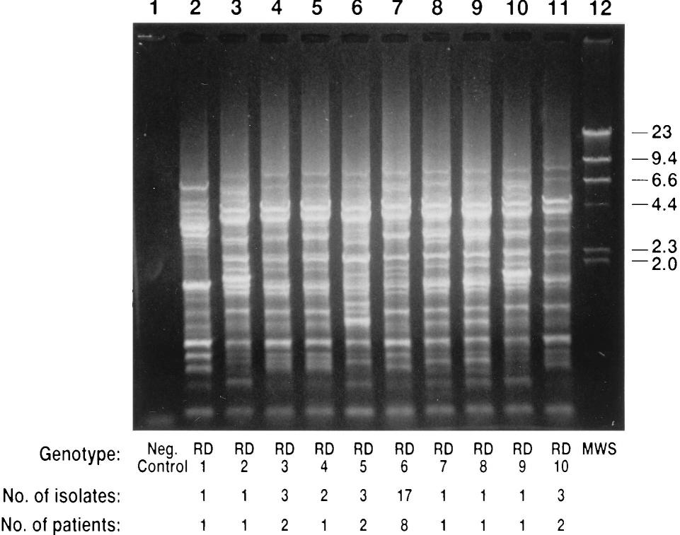 VOL. 35, 1997 K. PNEUMONIAE ASSOCIATED WITH UTI 2371 FIG. 1. DNA fingerprinting of 10 different representative isolates of K. pneumoniae.