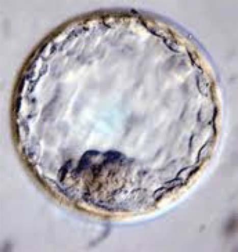 Embryonic stem cells are isolated from preimplantation blastocysts an early