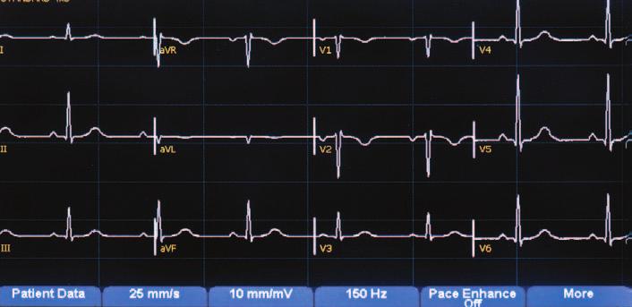 configurable to meet your needs On-screen preview of 12-lead waveforms and ECG results helps